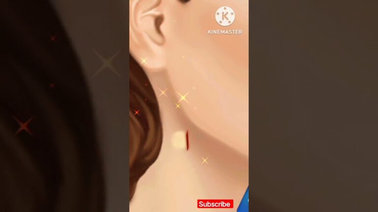 ASMR Cyst Removal Surgery || Arpi ASMR Video #shorts #viral #shortsvideo#youtubeshorts#asmr