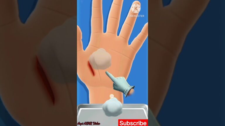 Bad condition of the Hand 🤚 || How to Treat Palm🤚 #shorts #viralasmr