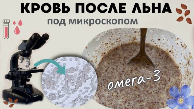 Кровь течет, как быстрая река! …после льна Кровь течет, как быстрая река! …после льна