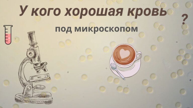 Пить кофе, делать уколы, есть все подряд… Что в итоге с кровью ? Пить кофе, делать уколы, есть все подряд… Что в итоге с кровью ?