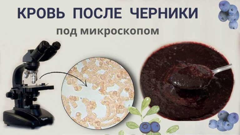 Как съеденная черника повлияет на состояние крови.
