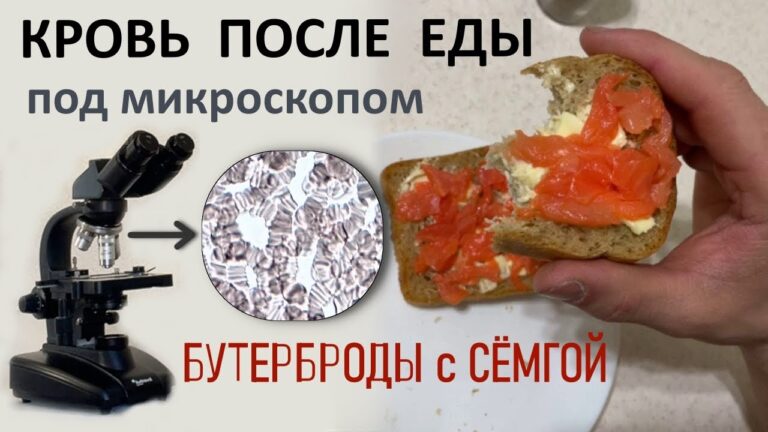 Что стало с кровью после бутербродов с красной рыбой.