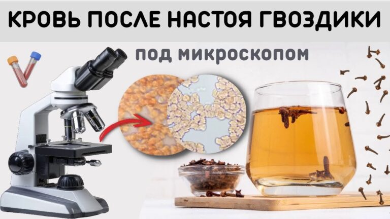 Как меняется кровь после употребления настоя гвоздики самой гвоздики. Как меняется кровь после употребления настоя гвоздики самой гвоздики.