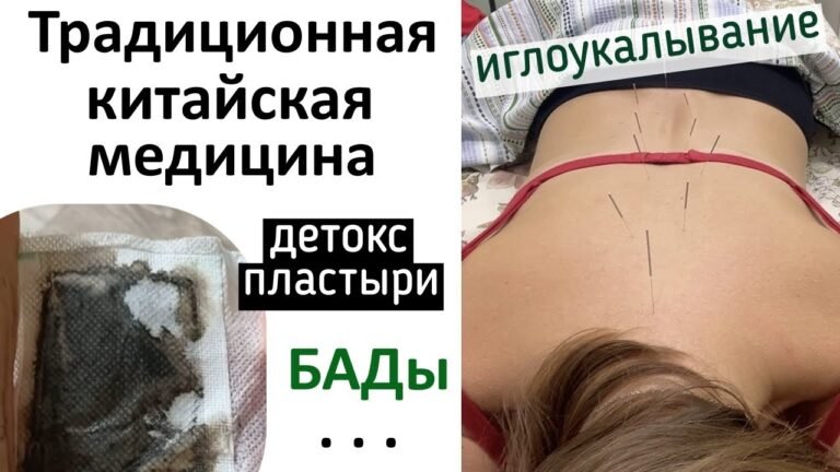 Китайская медицина : иглоукалывание, пластыри, бады…