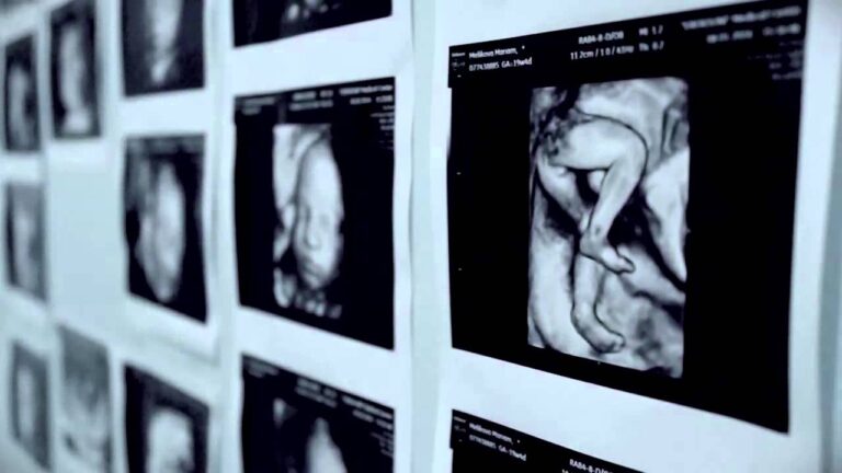 Ապրել եմ ուզում   (Aprel em uzum)