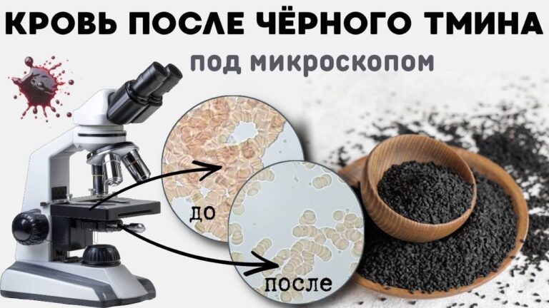 Как черный тмин влияет на состояние крови. 👍🏻 3 проверки в одном видео !