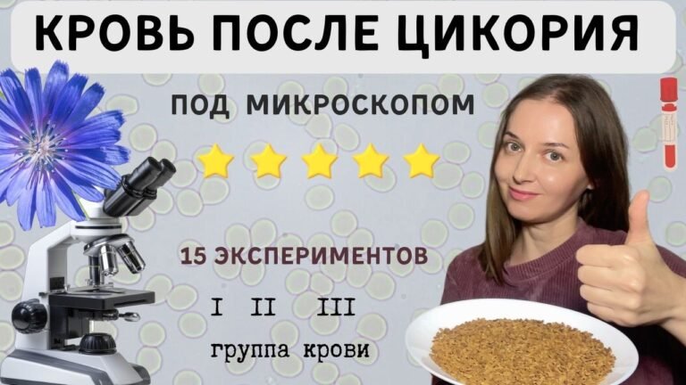Удивительное действие цикория на кровь ! Полезно знать каждому!
