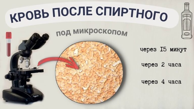 Водка, коньяк – как влияют на состояние крови