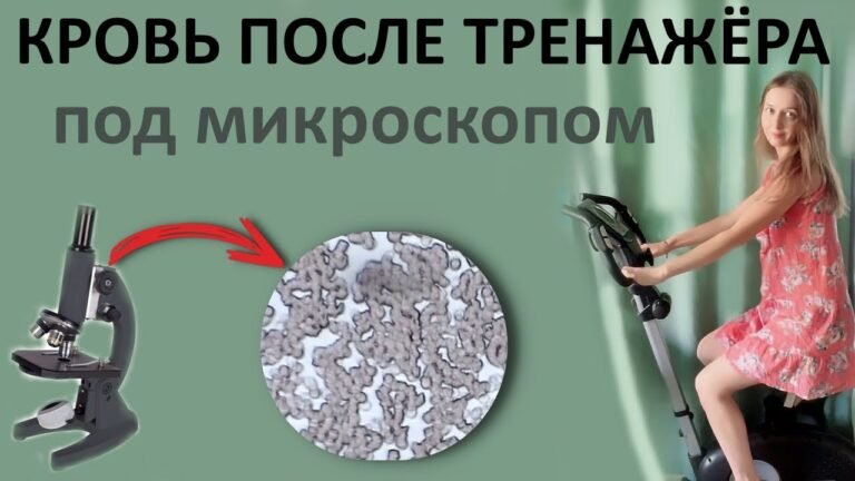 Как физ нагрузки влияют на состояние крови – разжижают или сгущают кровь?