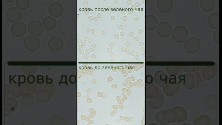 Зеленый чай (слабая заварка) хорошо влияет на состояние крови!